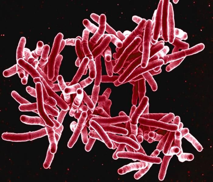 Mycobacterium tuberculosis