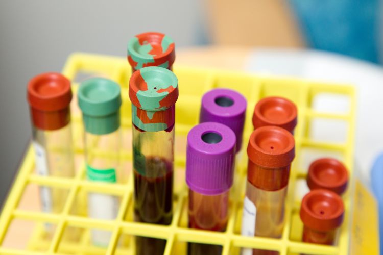 Stock image of blood vials