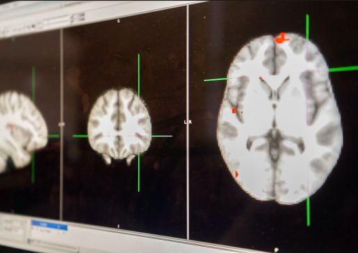 brain scans for asthma neurocircuitry research